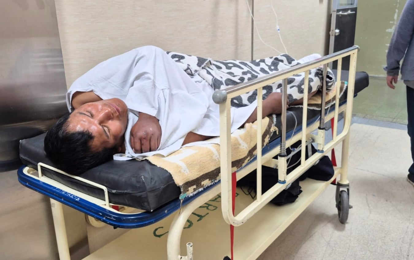 Indigente que fue víctima de secuestro al paso en Socabaya permanece en el hospital Honorio Delgado de Arequipa. (Foto: Pedro Torres/@photo.gec)