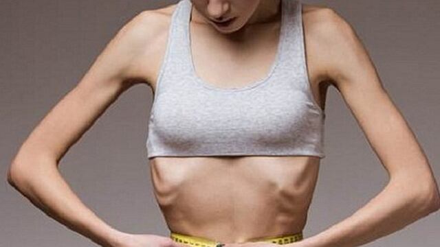 EE.UU : ​Autorizan a morir de hambre a una paciente que padece de anorexia