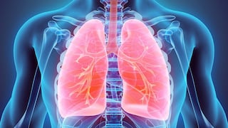 Hipertensión arterial pulmonar afectaría a unas 3 mil personas en Perú