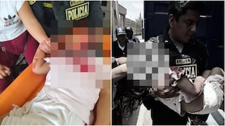 Ica: perro callejero muerde en la cabeza a menor de 4 años y la deja herida