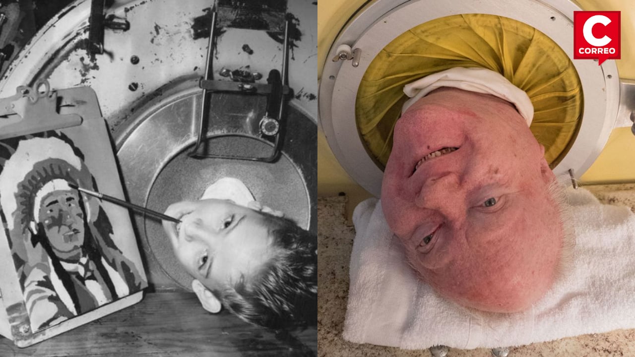 Paul Alexander, el hombre que vivió por más de 70 años en un ‘pulmón de acero’ murió a los 78 años