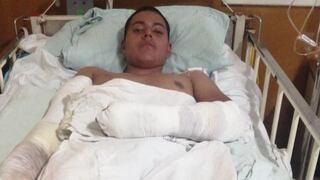 Amputan brazo a soldado que sufrió fuerte descarga eléctrica en Tacna