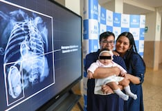 EsSalud: Realizan primer implante de marcapaso en bebé prematura de Latinoamérica