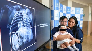 EsSalud: Realizan primer implante de marcapaso en bebé prematura de Latinoamérica