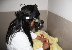 Piura: Médicos del Hospital de Sullana operan a gemela prematura y logran que recupere la visión