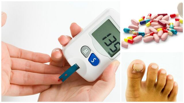 ¡Cuidado! Este medicamento para diabéticos podría causar amputación