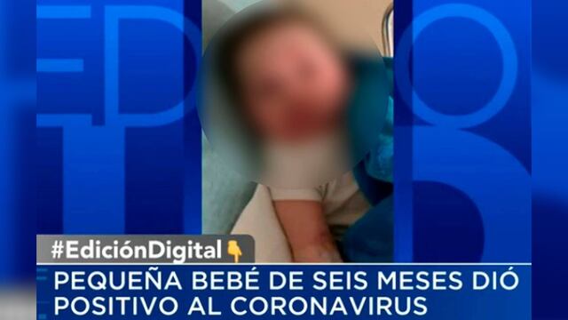 Bebé de 6 meses con COVID-19 lucha por su vida: Médicos creían que tenía una “extraña alergia”