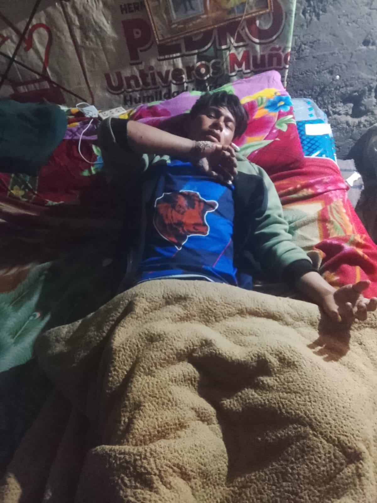 Joven termina con quemaduras en las manos al intentar combatir el fuego.