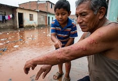 Fenómeno El Niño: Minsa alerta sobre problemas en la piel por calor, humedad y lluvias