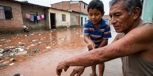 El Hospital Nacional Cayetano Heredia recomienda reforzar el cuidado de la piel ante las condiciones asociadas al Fenómeno El Niño. Picazón persistente, pus o lesiones que se extienden requieren evaluación médica. (Imagen: IA/Con fines ilustrativos)