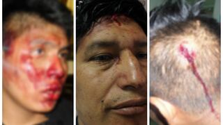 Apurímac: Vigilantes de la UNAMBA agredidos por turba de estudiantes y docentes