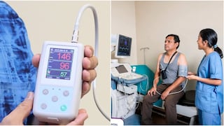 Hospital Regional de Ica incorpora nuevos equipos para mejorar diagnóstico cardiológico