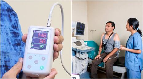 Hospital Regional de Ica incorpora nuevos equipos para mejorar diagnóstico cardiológico