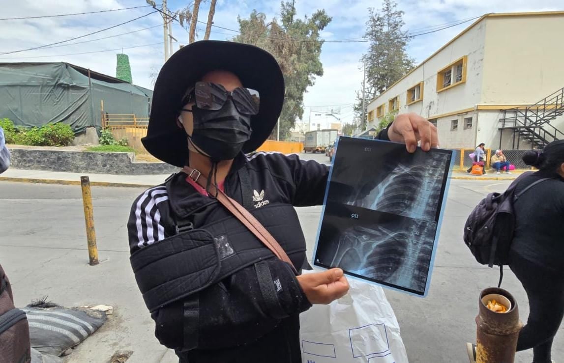 Madre sobreviviente al ataque en Majes pide ayuda para costear tratamiento de sus hijos (Foto: Omar Cruz/@photo.gec)