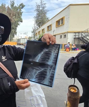 Madre sobreviviente al ataque en Majes pide ayuda para costear tratamiento de sus hijos (Foto: Omar Cruz/@photo.gec)