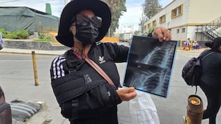 Madre sobreviviente al ataque en Majes pide ayuda para costear tratamiento de sus hijos (VIDEO)