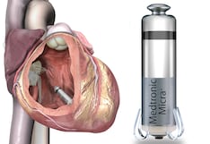 Marcapasos Micra sin cables reduce infecciones y mejora la vida de pacientes cardíacos