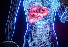 Más del 70% de los cánceres de hígado en Perú se detectan en etapa avanzada, alertan especialistas