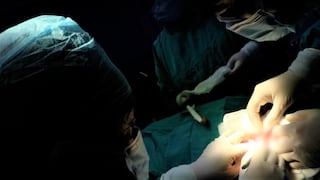 Piura: Realizan trasplante de córnea a hombre que se le incrustó parte de una rama en el ojo