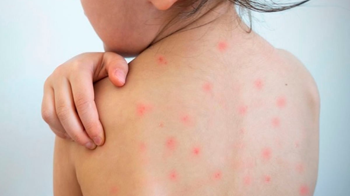 Autoridades y especialistas advierten sobre la urgencia de reforzar la vacunación infantil ante el inicio de la temporada alta de infecciones respiratorias en el país. (Foto referencial: Andina)