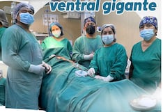 Nasca: realizan compleja cirugía para corregir hernia ventral gigante en paciente de 46 años