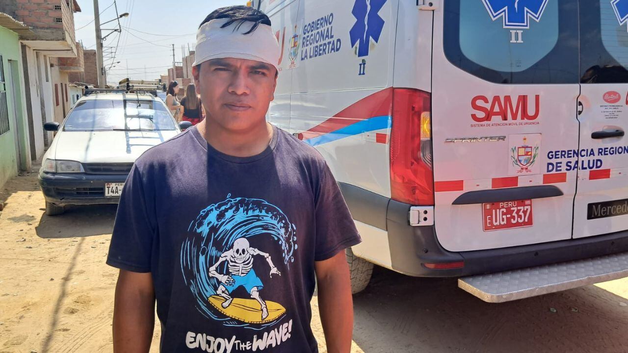 Luis Rodríguez Inga agradece a Dios por permitirle vivir tras la explosión que destruyó su vehículo. Ahora lo que le preocupa es no tener dinero para que su hijo que padece leucemia reciba atención especializada en Lima.