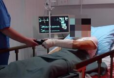 Huancayo: Padre denuncia que policías le habrían roto el brazo a su hijo durante intervención