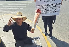 Arequipa: Un año sin justicia para el mecánico que perdió una pierna tras accidente