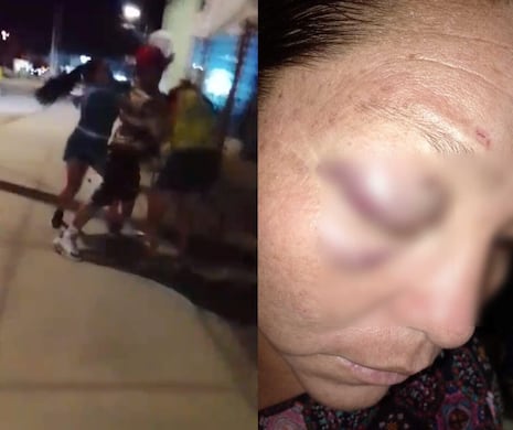 Chiclayo: madre e hija gestante de 14 años denuncian agresión física en Tumán