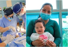 Gran campaña gratuita de cirugía de labio leporino y paladar hendido en el Hospital Regional de Ica