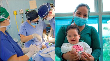 Gran campaña gratuita de cirugía de labio leporino y paladar hendido en el Hospital Regional de Ica