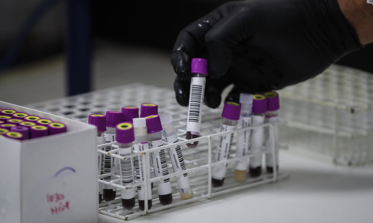 El Centro de Investigaciones Tecnológicas, Biomédicas y Medioambientales de la UNMSM desarrolla estudios clínicos rigurosos para evaluar la seguridad y eficacia de vacunas contra el VIH. (Foto: EFE)