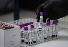 Perú participa en ensayos clínicos para una vacuna contra el VIH desde San Marcos