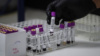 Perú participa en ensayos clínicos para una vacuna contra el VIH desde San Marcos