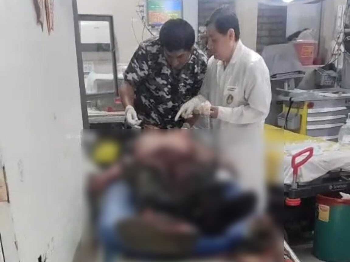 Menor herido fue trasladado a hospital Belén.