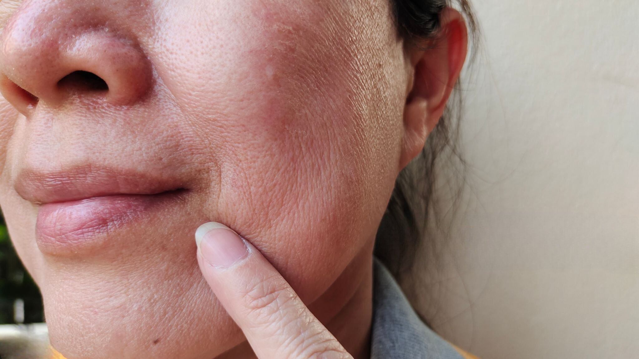 Si es detectado tempranamente el cáncer bucal es curable