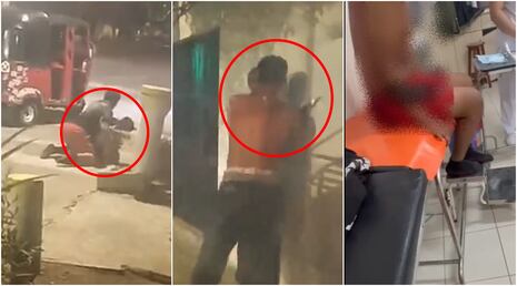 Ica: ataca con cuchillo de 30 centímetros a mototaxista y lo dejó herido en Parcona