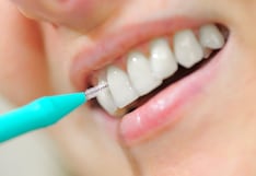 Los espacios entre los dientes también necesitan limpieza: cómo usar correctamente el cepillo interproximal