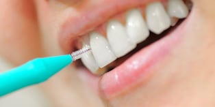 La limpieza entre los dientes sigue siendo una práctica poco frecuente, pese a que ayuda a prevenir la acumulación de placa bacteriana y reduce el riesgo de caries y enfermedades periodontales. Un especialista explica cómo utilizar correctamente los cepillos interproximales.