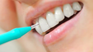 Los espacios entre los dientes también necesitan limpieza: cómo usar correctamente el cepillo interproximal