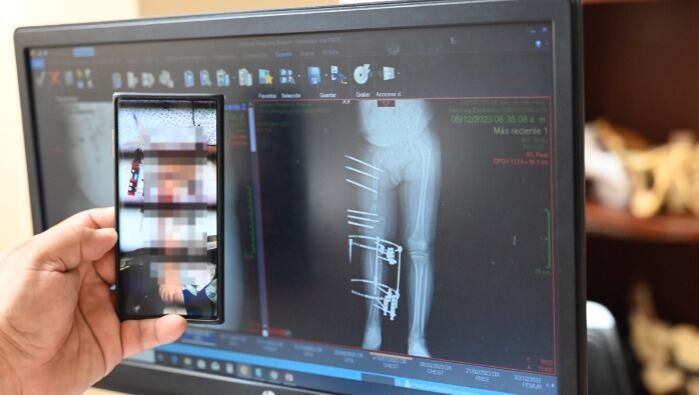 Foto: hospital del niño