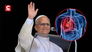 ¿Qué significa tener un nódulo pulmonar? Esto explica un oncólogo tras el caso del papa León XIV