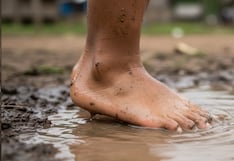 Inundaciones en Lima Sur: cómo prevenir la leptospirosis y el dengue, según el Minsa