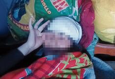 Junín: Caso de agresión escolar en San Jerónimo podría ser tipificado como “intento de homicidio”