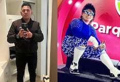 Pisco: solicitan apoyo solidario para el payasito “Pulserita Kids”, tras sufrir fractura de pierna