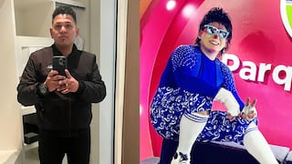 Pisco: solicitan apoyo solidario para el payasito “Pulserita Kids”, tras sufrir fractura de pierna