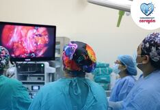 EsSalud Ica realizan cirugía de cáncer de colon con técnica laparoscópica