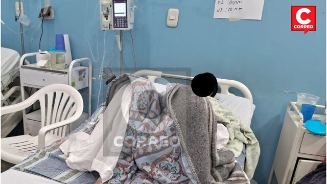 Huancayo: Niño con el 60% del cuerpo quemado corre riesgo de sufrir una infección grave