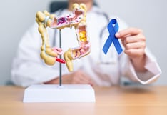 Cuatro medidas clave para reducir el riesgo de cáncer de colon, según especialistas
