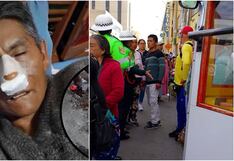 Ica: joven de 20 años golpea a vendedor y le causó grave fractura en la nariz